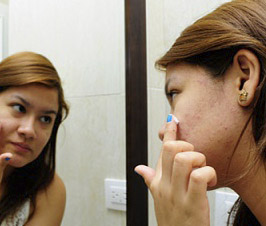 Jóvenes en conflicto: llegó el acné